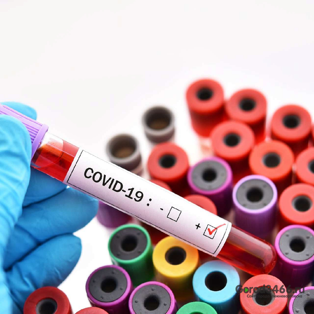 3 273 новых случая COVID-19 выявлено в Югре за сутки 