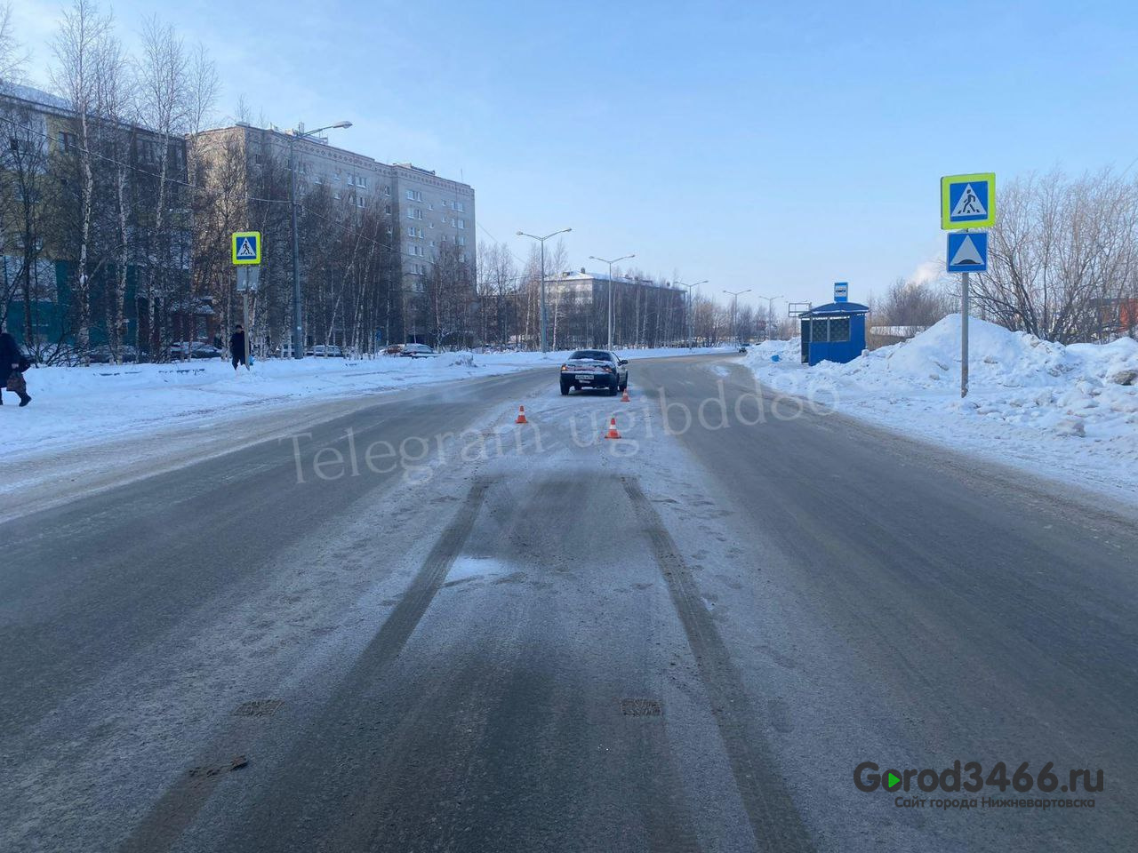 В Нижневартовске на пешеходном переходе сбили женщину