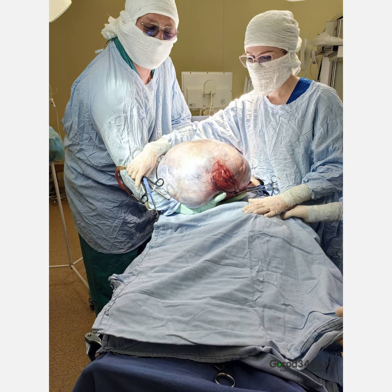 В Югре врачи удалили пенсионерке 15-килограммовую опухоль