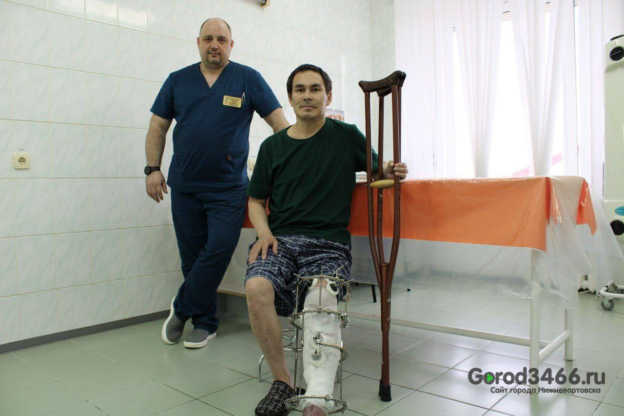 В Югре врачи спасли мужчине ногу, который раздробил ее бревном на стойбище